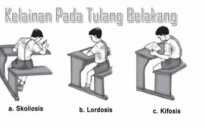 Kelebihan Dan Kekurangan Penyebab Dan Mengobati Skoliosis Dengan Pilates