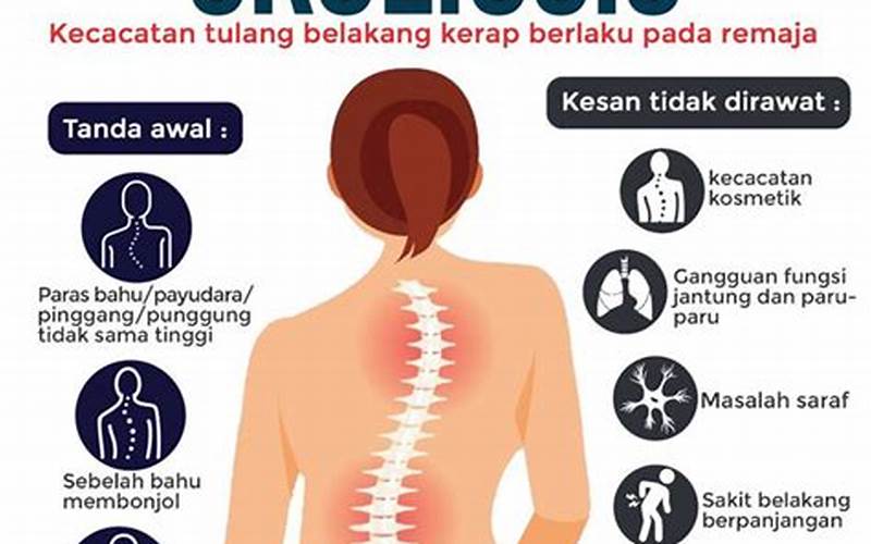 Tabel Penyebab Dan Mengobati Skoliosis Dengan Pilates